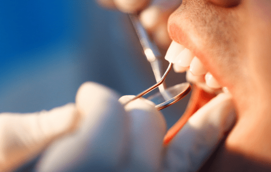 reconstruccion dental las palmas prueba