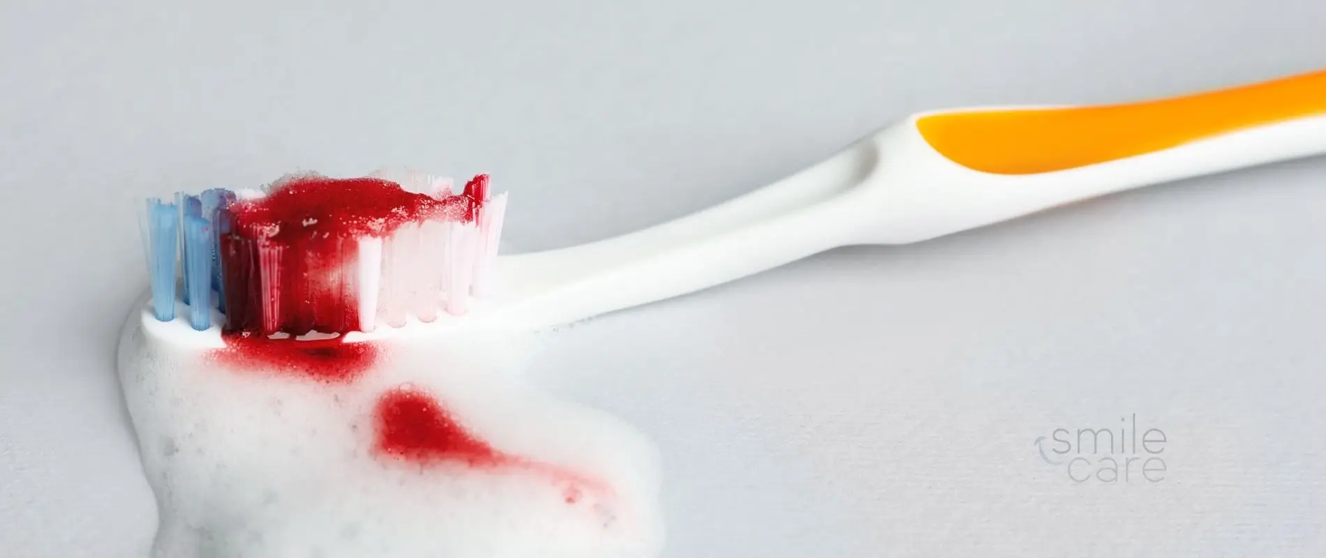 Cepillo dental con sangre: prevenir la gingivitis dentista Las Palmas