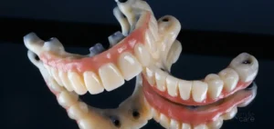 Prótesis dentales completa superior en inferior
